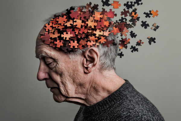 Centro de Día Conde Alyó